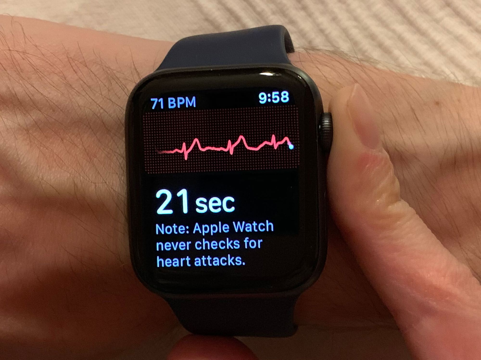 does apple watch 5 have ekg